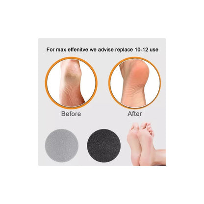 Maquina Removedor De Callos Lima Para Pies Recargable - Chamos Store
